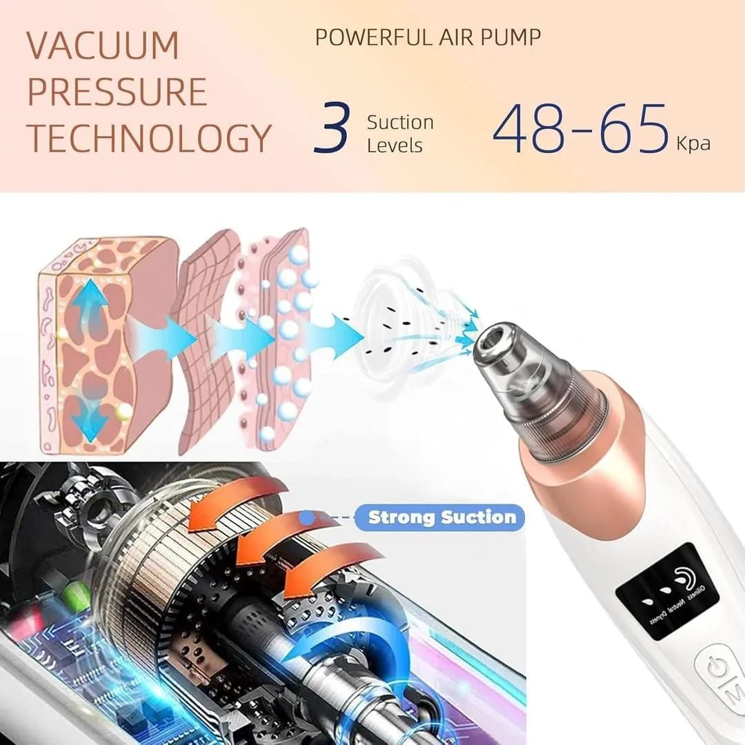 5-in-1 Blackhead remover _ Multi-Functional _With Rechargeable 🔋