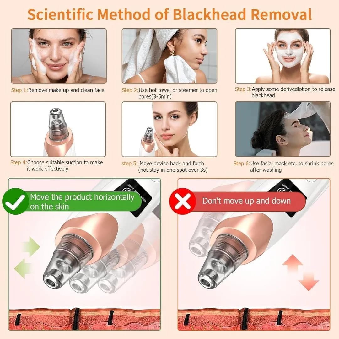 5-in-1 Blackhead remover _ Multi-Functional _With Rechargeable 🔋